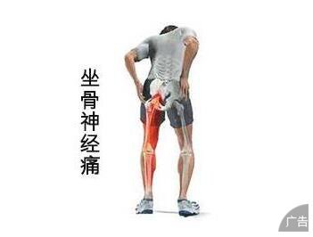 患有坐骨神经痛有哪些症状表现
